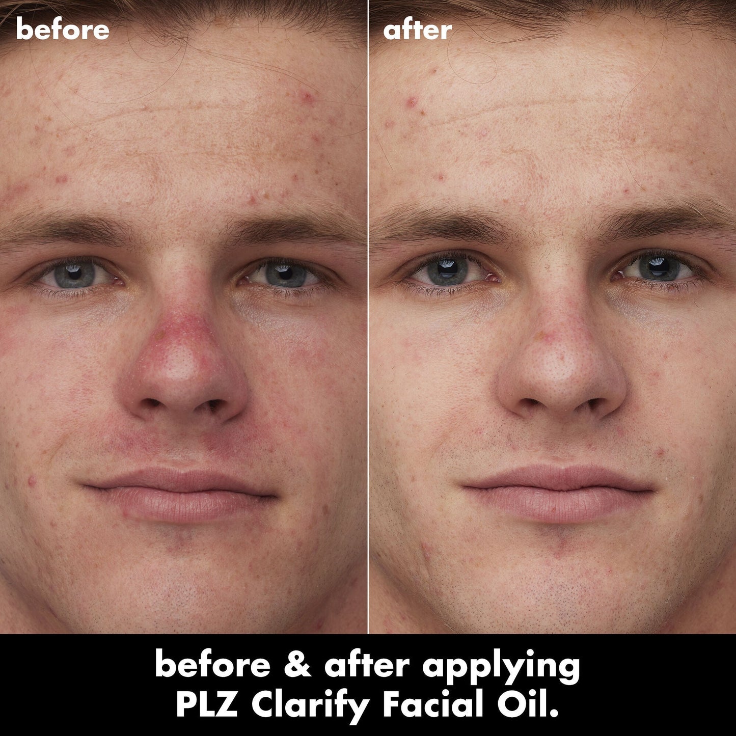 plz-clarify-facial-oil-g7 0326_EDU_PlzClarify_BA_Caleb.jpg