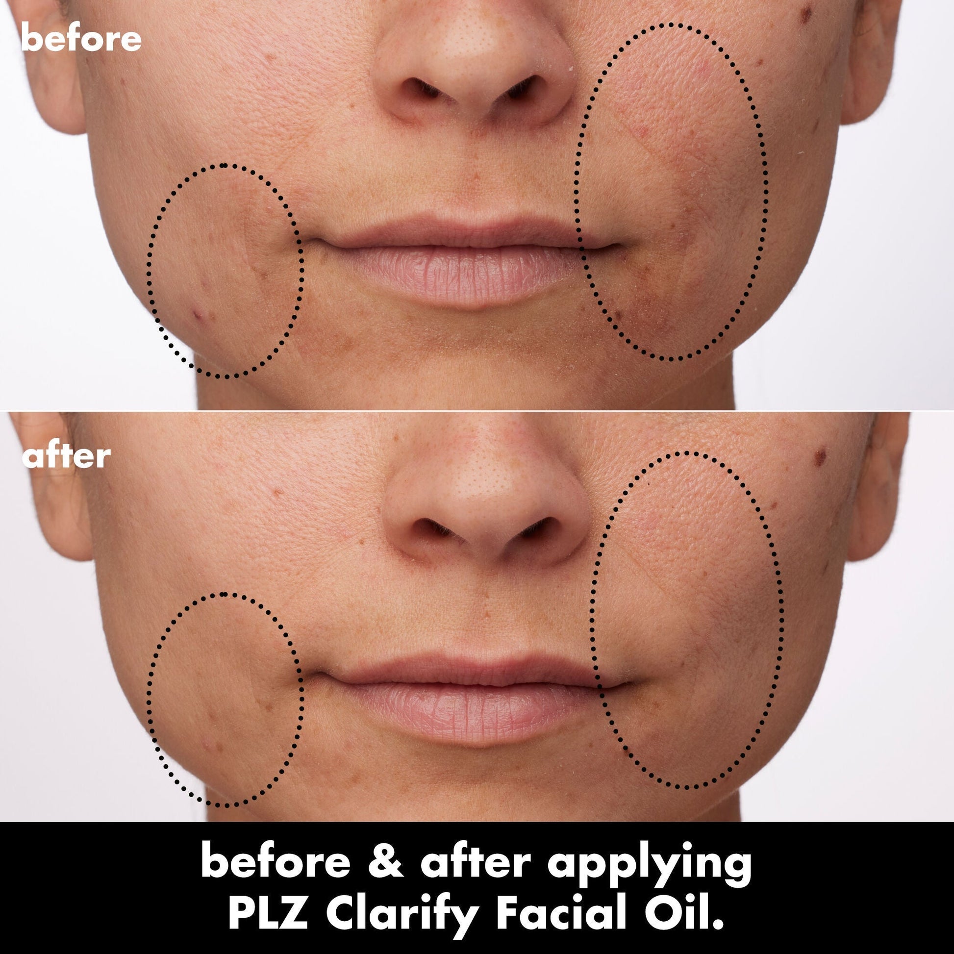 plz-clarify-facial-oil-g7 0326_EDU_PlzClarify_BA_Paula.jpg