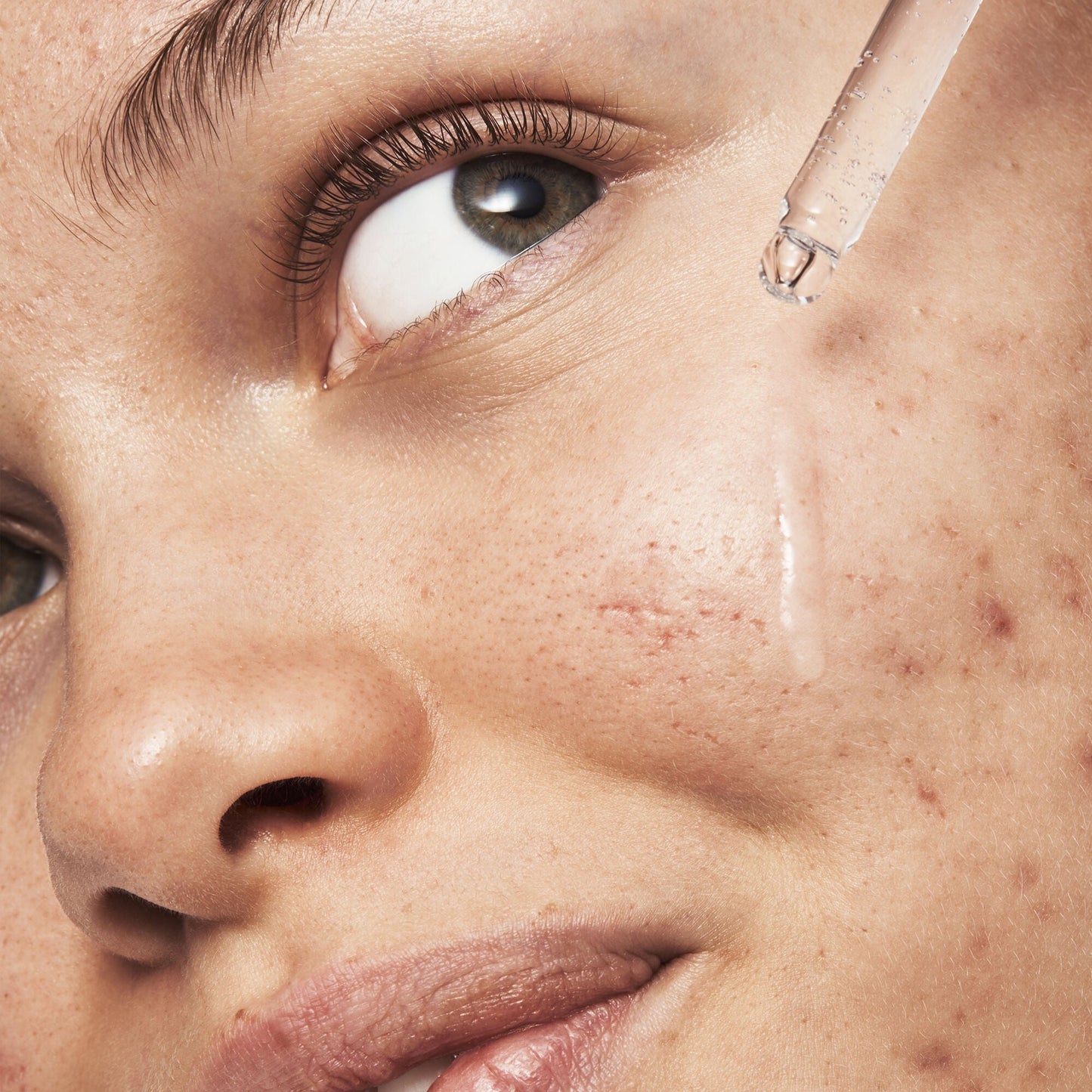 blemish-breakthrough-triple-acid-resurfacing-serum-j6 121321_Marley-Acne-Regimen_0254_FINAL_IGF.jpg